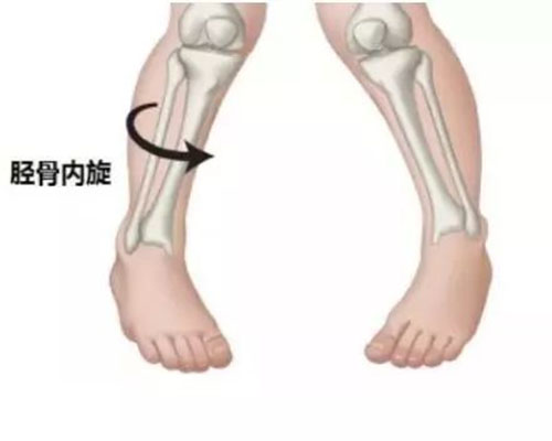 北京減肥夏令營(yíng)，減肥夏令營(yíng)